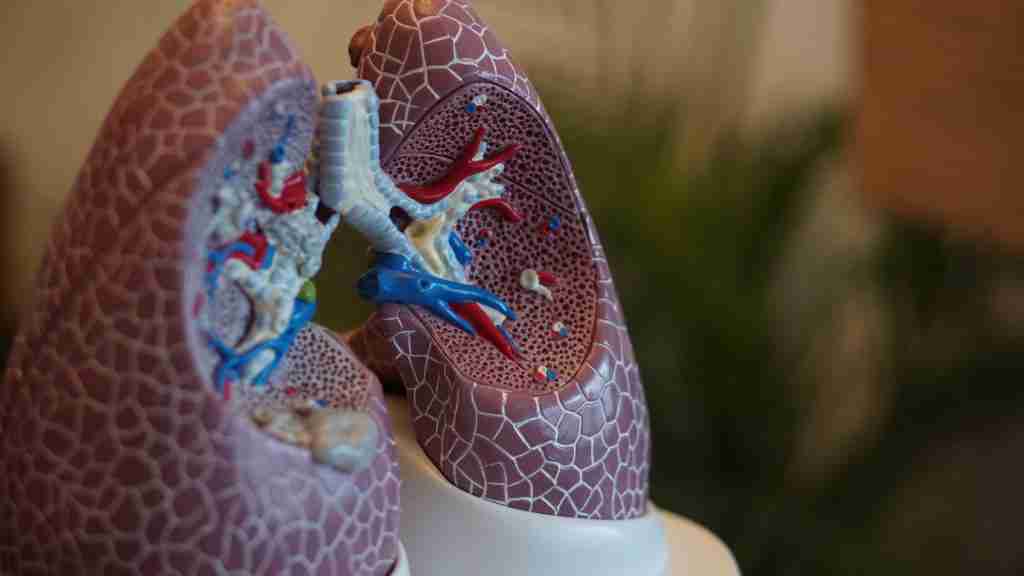 Chronic Obstructive Pulmonary Disease - Pulmonary fibrosis